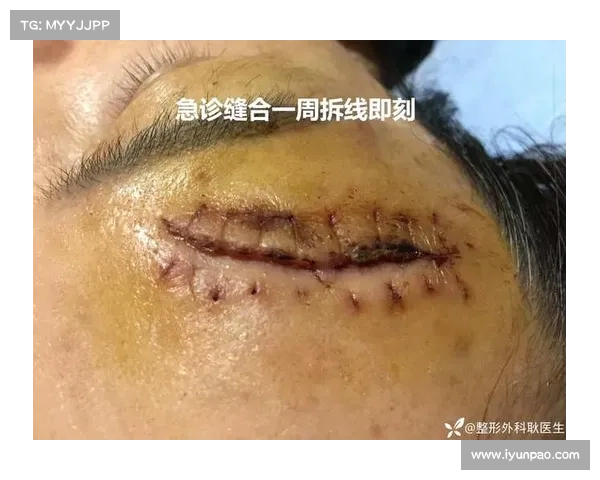 辐射烧伤皮肤痒有暗红块如何治疗 辐射烧伤皮肤痒有暗红块如何治疗